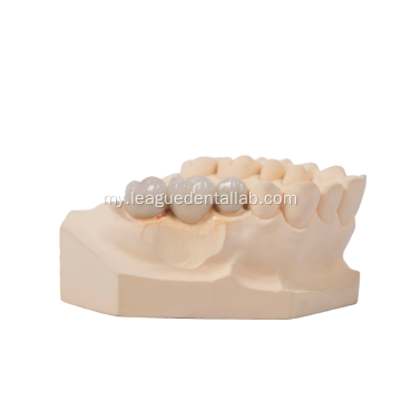 zirconia ကြွေထည်သတ္တုသရဖူမှ fused